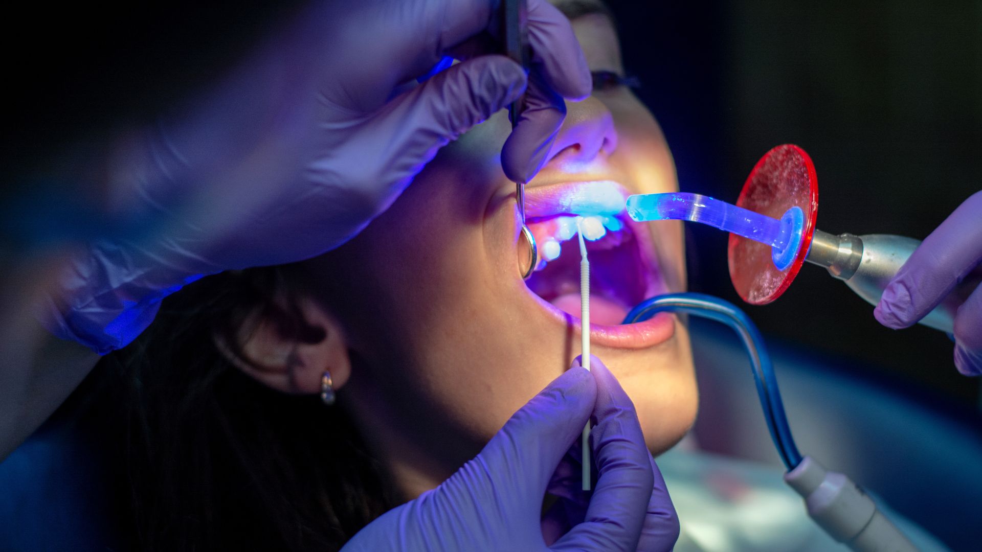 Dentists use dental lasers as they work on a patient's teeth.